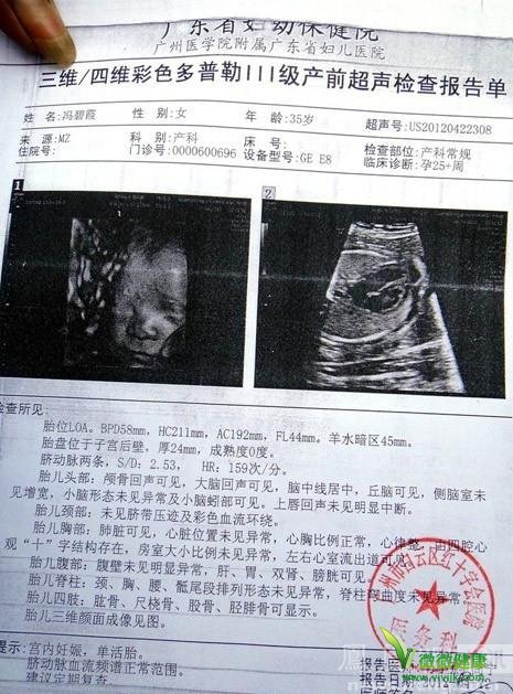 杨陵白云高龄孕妇被告知胎儿畸形后跳楼身亡 